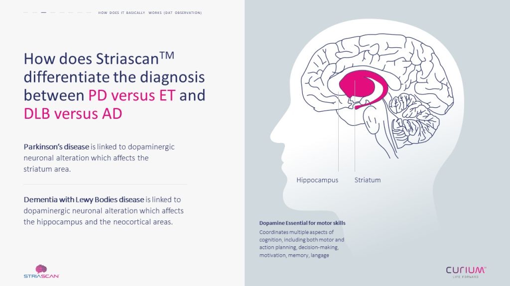 Schéma du cerveau expliquant les zones concernées par Striascan